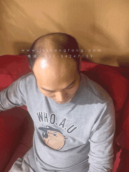 �������ǵȴ���ȷ���ж�ʱ�����Է�������û�������û������1