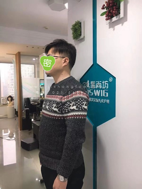 ���з��޺����������̶���ʽ�����ȶ���ʹ�����ι̵ظ���ͷ��5