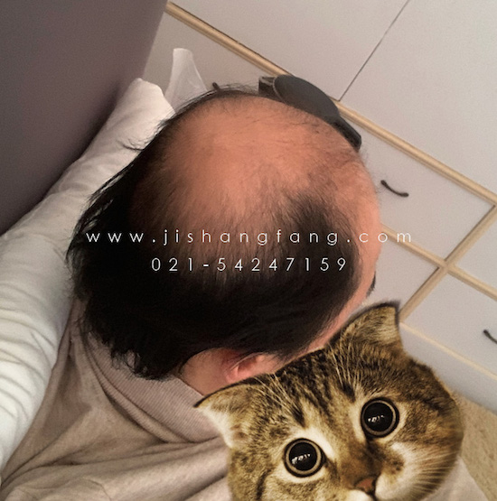 �����ǵ����� ���� ���� �������Ǹ��õ�����ͷ���2